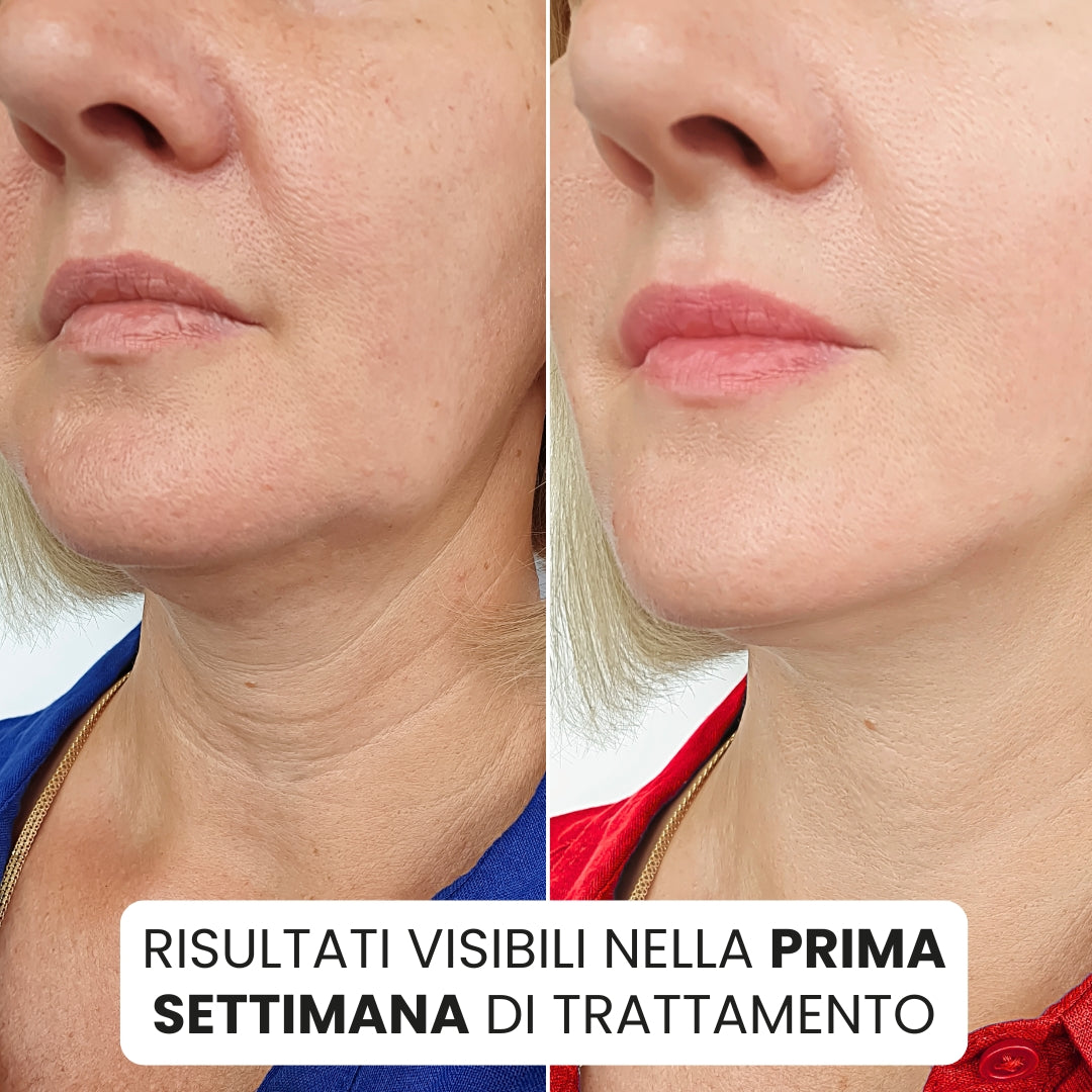 Aubéra® | Maschera viso con estratto di melanzana